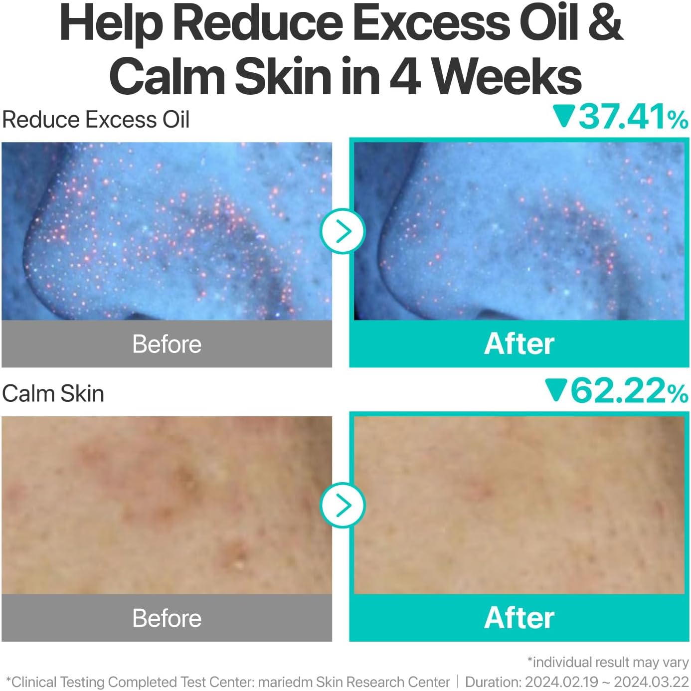 Numbuzin No.1 Pantothenic B5 Active Soothing Serum — helps strengthen the moisture barrier