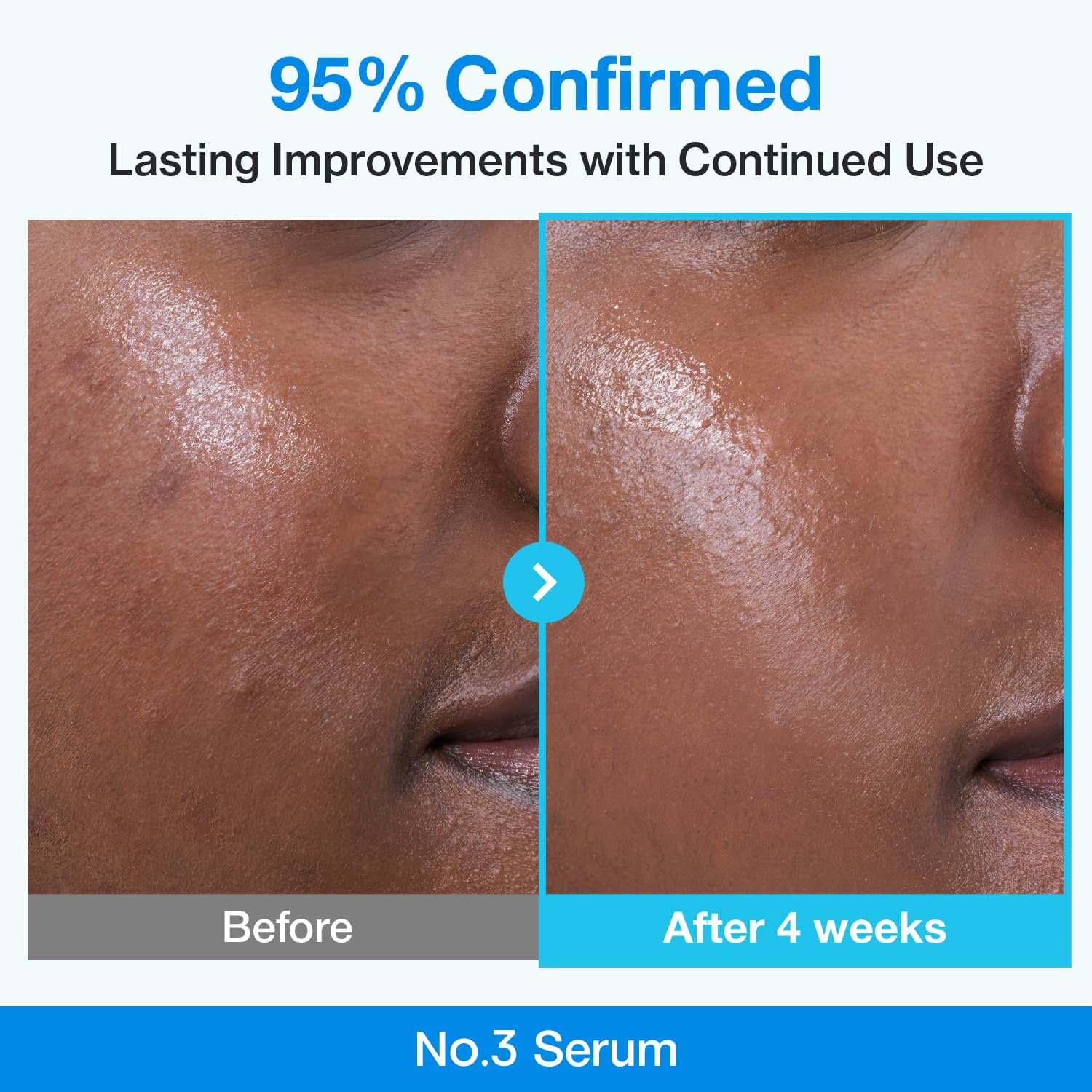 Numbuzin No.3 Blue Bio-Retinol Pore Refining Serum — gentle bio-retinol smooths skin texture