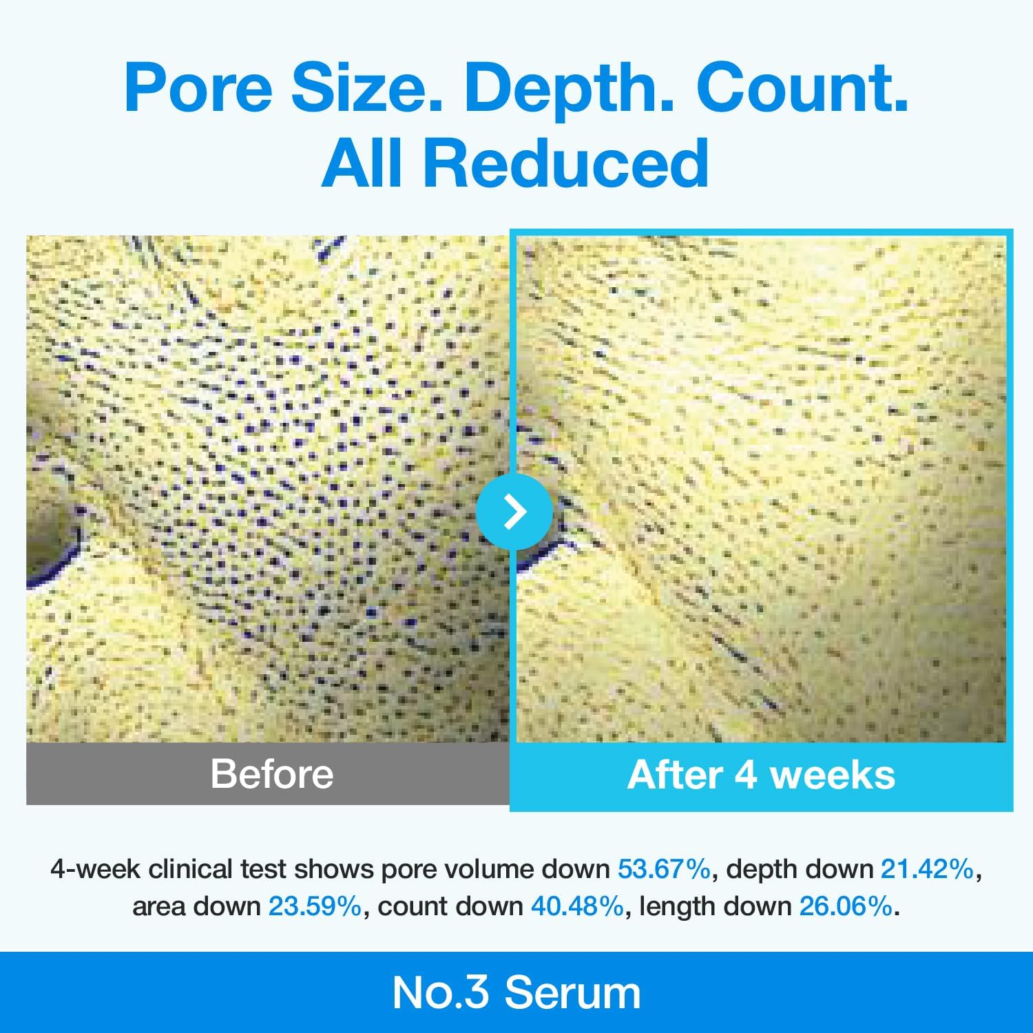 Numbuzin No.3 Blue Bio-Retinol Pore Refining Serum — refines and minimizes the look of pores