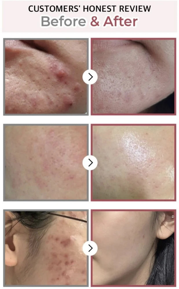 Numbuzin No.3 Skin Softening Serum — how to use: apply a few drops after toner, morning and night