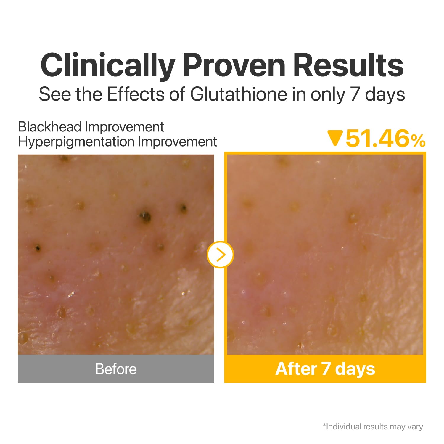 Numbuzin No.5+ Glutathione Vitamin Facial Spa Cleanser — leaves skin clean, soft and glowing