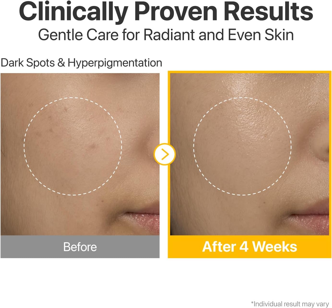 Numbuzin No.5 Vitamin Concentrated Serum — boosts radiance for a healthy, even glow