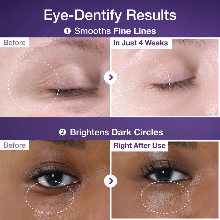 Numbuzin No.9 3 Days Eye Care Kit — everything needed for a 3-day eye care routine
