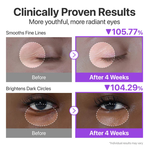 Numbuzin No.9 NAD Retinol Volumetox Eye Cream — targets the look of dark circles