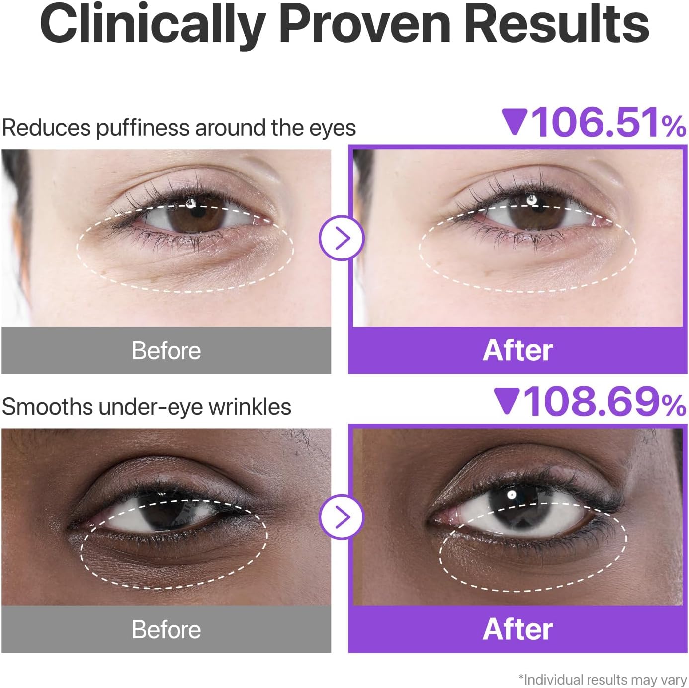 Numbuzin No.9 NMN+ Collagen Under Eye Patches — NMN and collagen target signs of aging