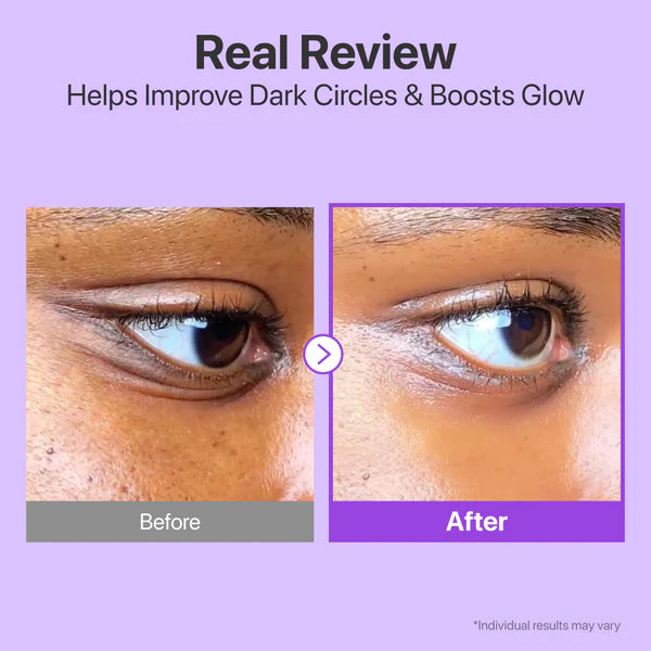 Numbuzin No.9 NMN Retinol Volumetox Eye Cream — delivers rich hydration to delicate eye skin