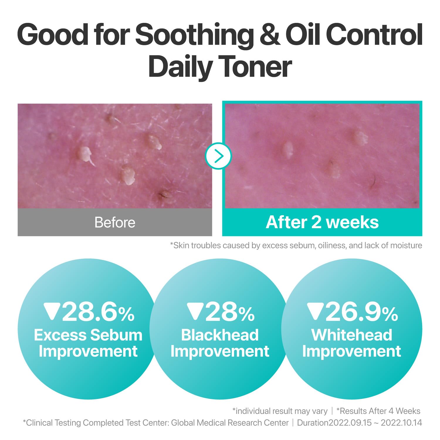 Numbuzin Pure-Full Calming Herb Toner — delivers lightweight, lasting hydration