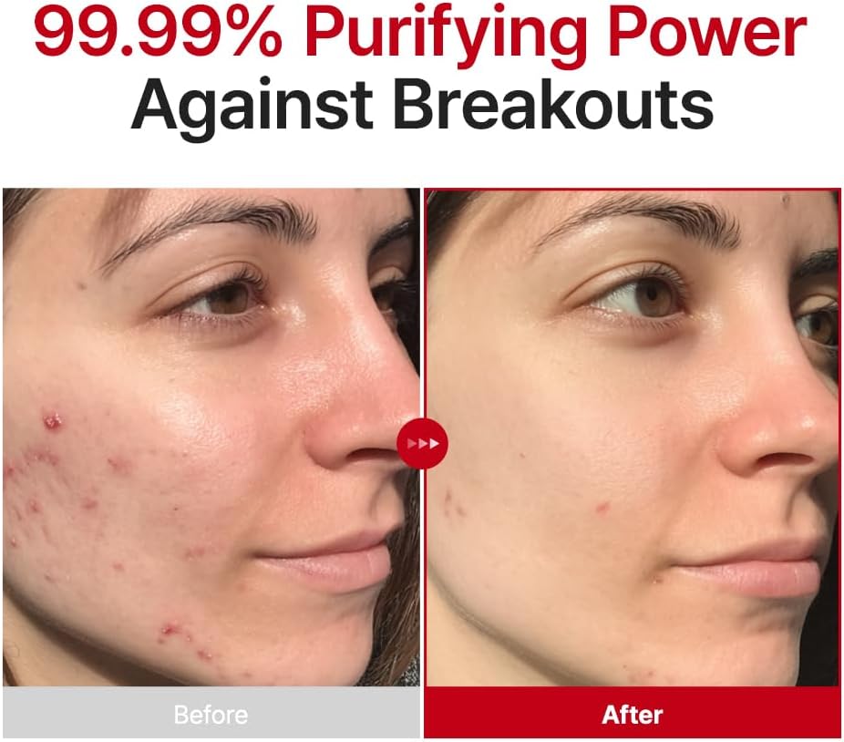 Purito Seoul Hypochlorous Acid Rescue Spray — lightweight mist refreshes skin anytime