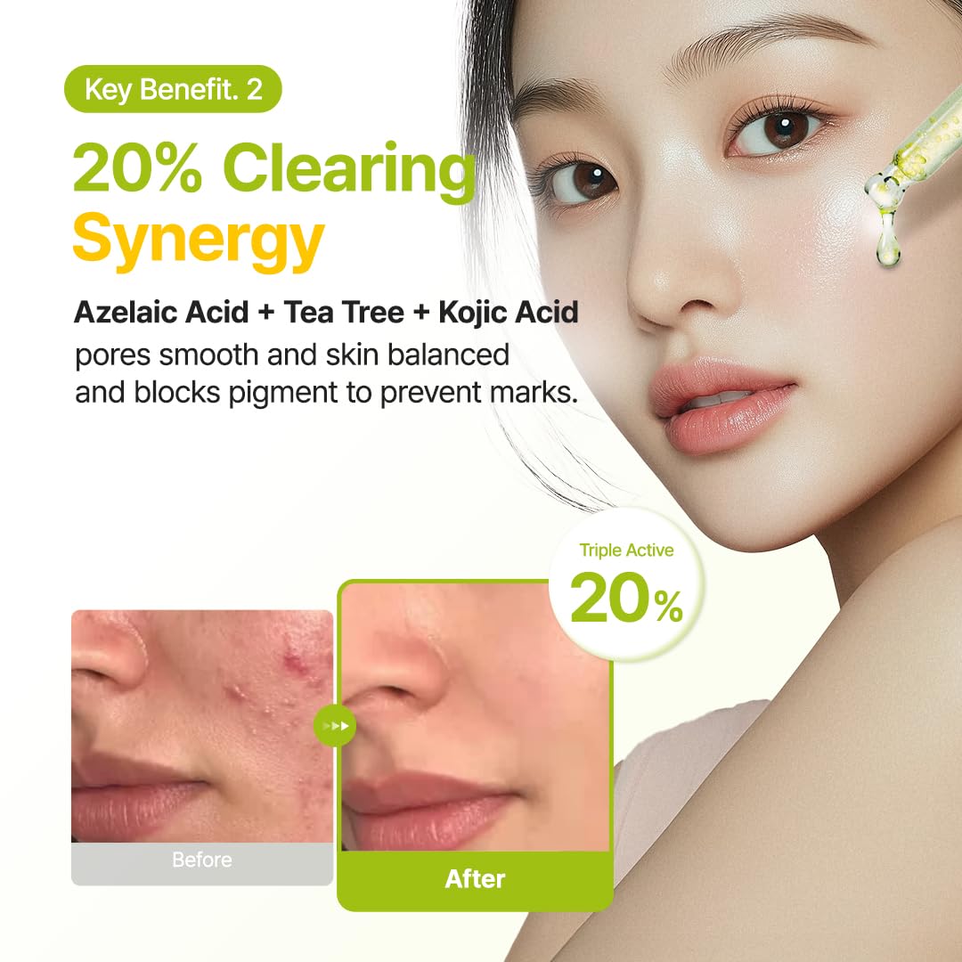 Purito Seoul Azelaic Acid 10 Kojic Azulene Serum — powered by 10% azelaic acid, kojic acid and azulene