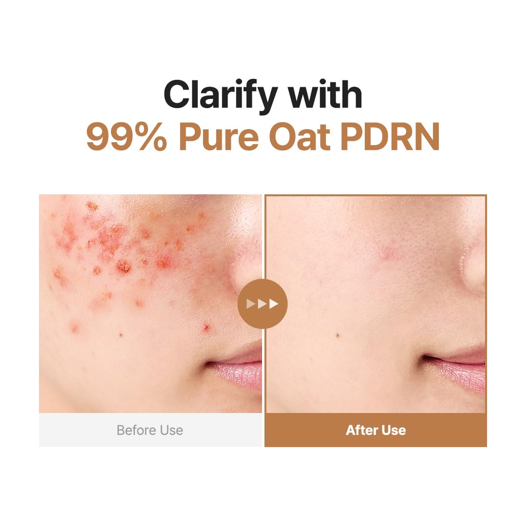 Purito Seoul Oat PDRN Gentle Refining Toner — oat extract soothes and calms skin
