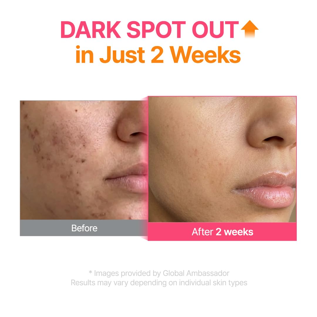 Purito Seoul TXA 6 Niacinamide 10 Retinal Serum — helps even out uneven skin tone