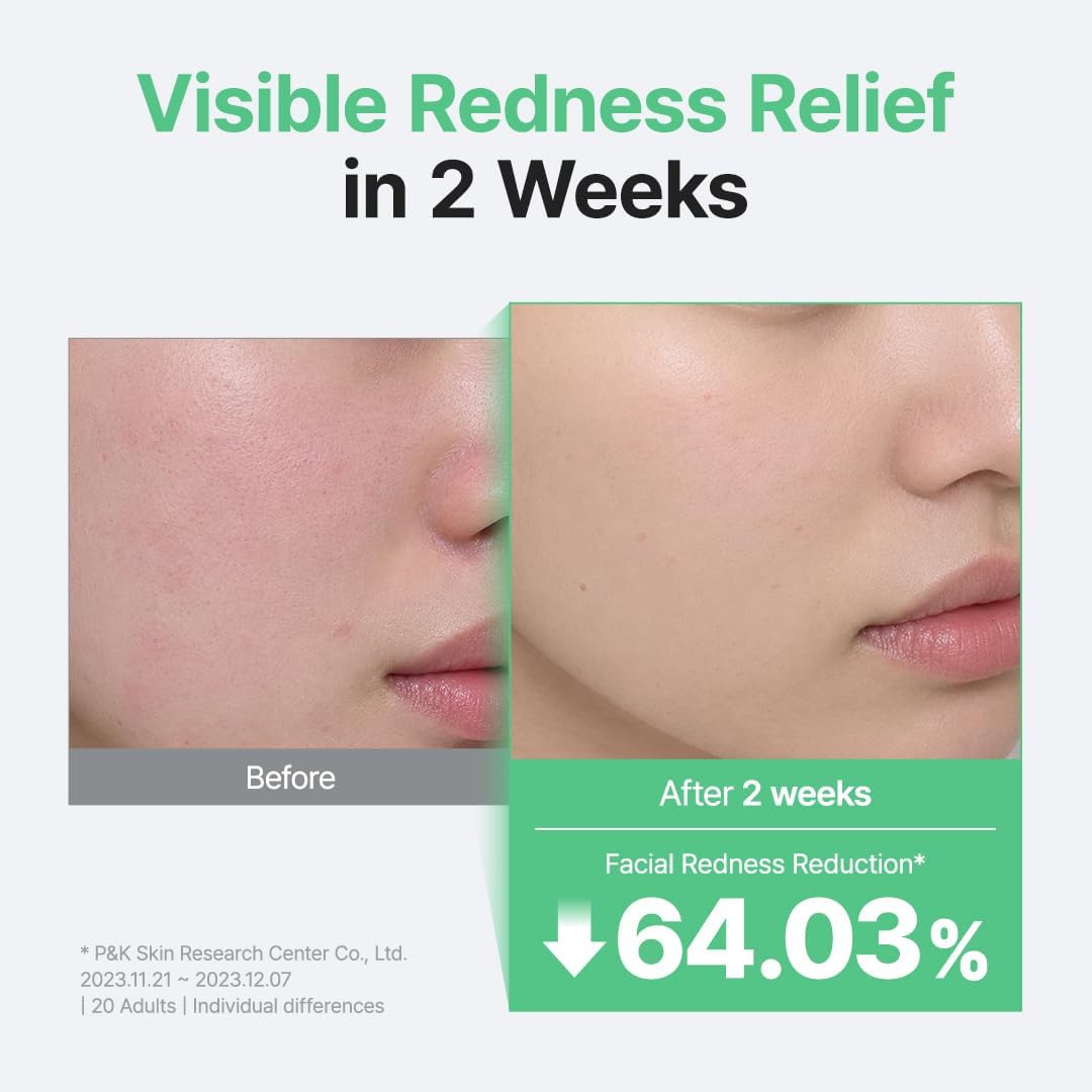 Purito Seoul Wonder Releaf Centella Serum Unscented — lightweight serum hydrates and comforts skin