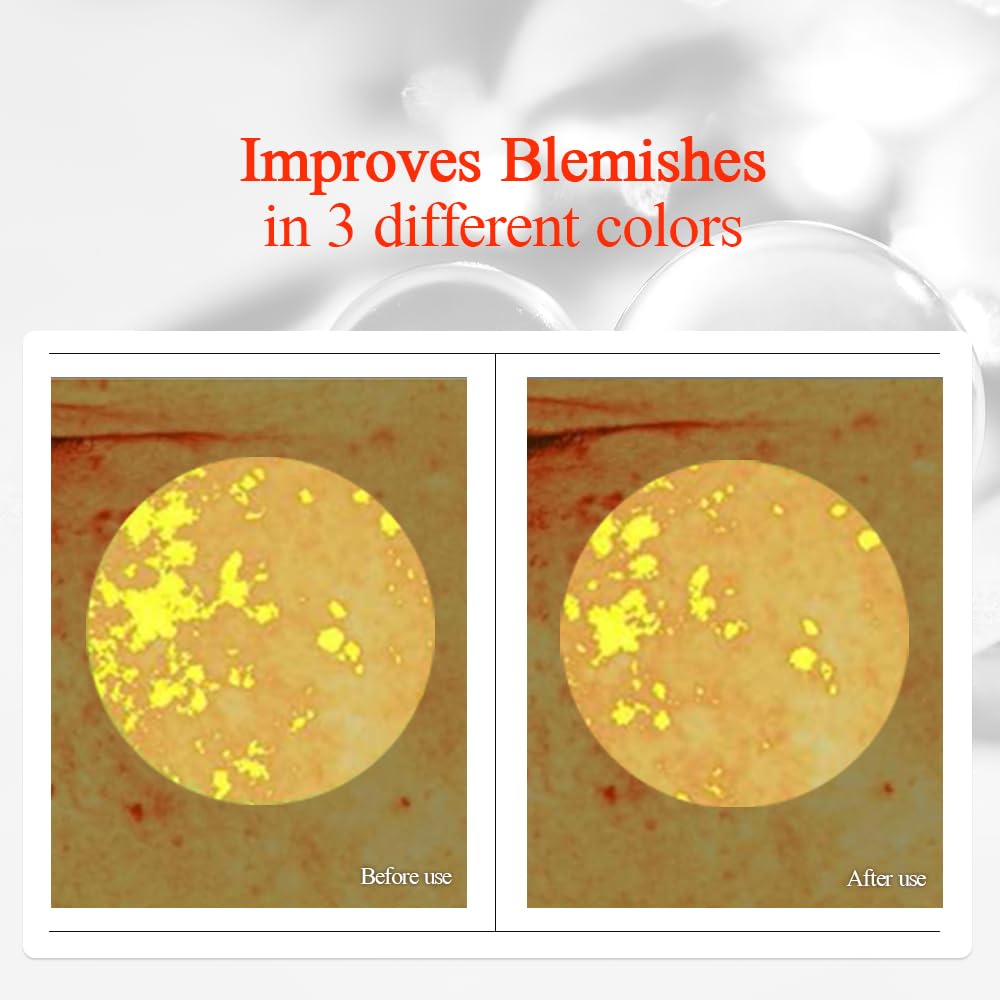 Targets the look of dark spots and post-blemish marks
