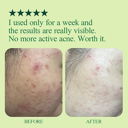 Made with mugwort and centella to calm irritation