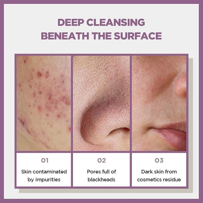 SKIN1004 Zombie Beauty Cocoon Soap Mask — cleanses and purifies pores