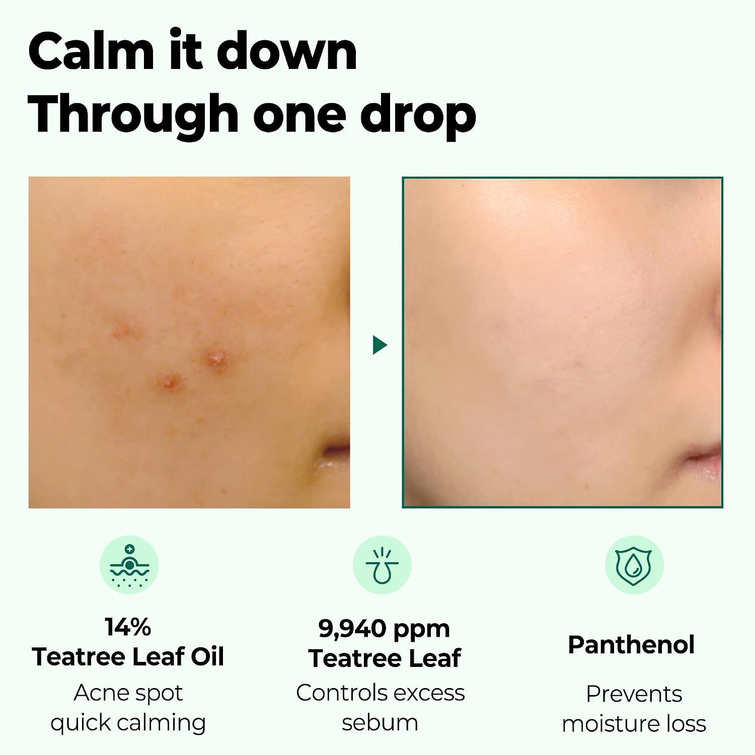 SOME BY MI 30 Days Miracle Tea Tree Clear Spot Oil — soothes blemish-prone skin