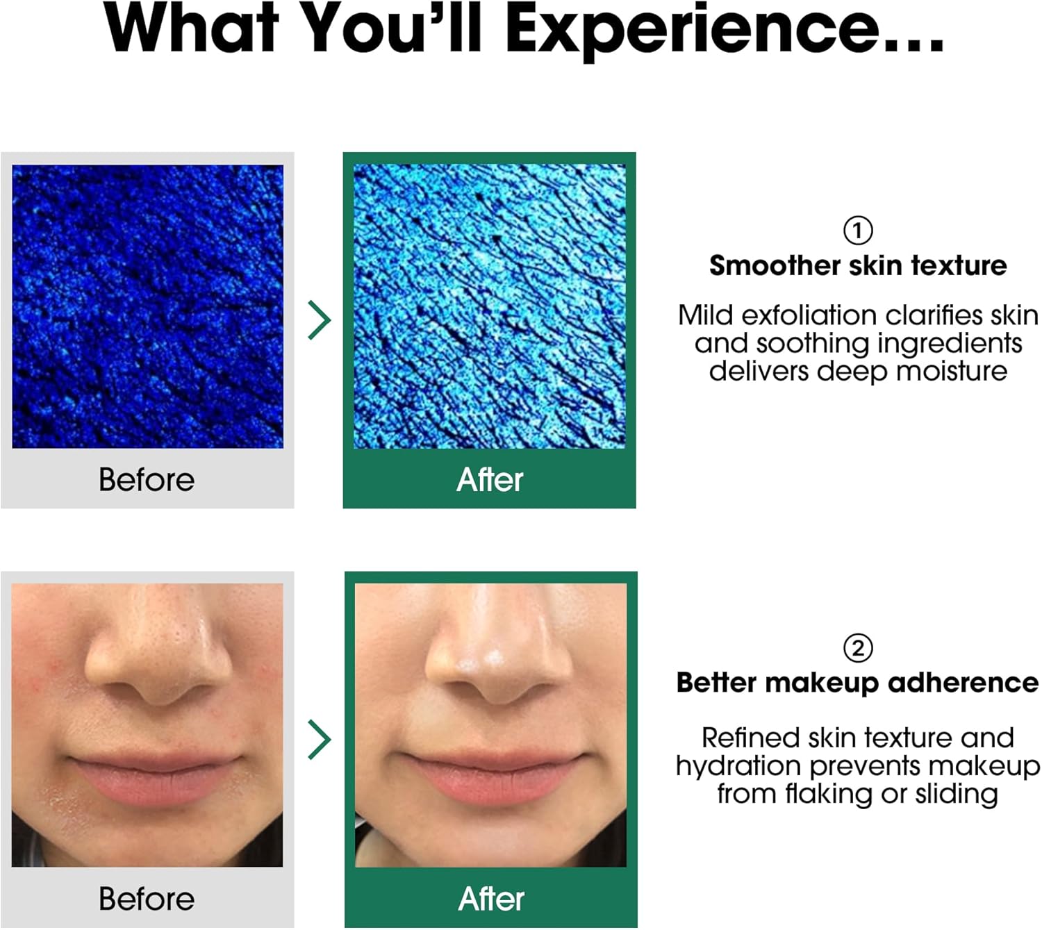 SOME BY MI AHA.BHA.PHA 30 Days Miracle Toner — hydrates and preps skin after cleansing