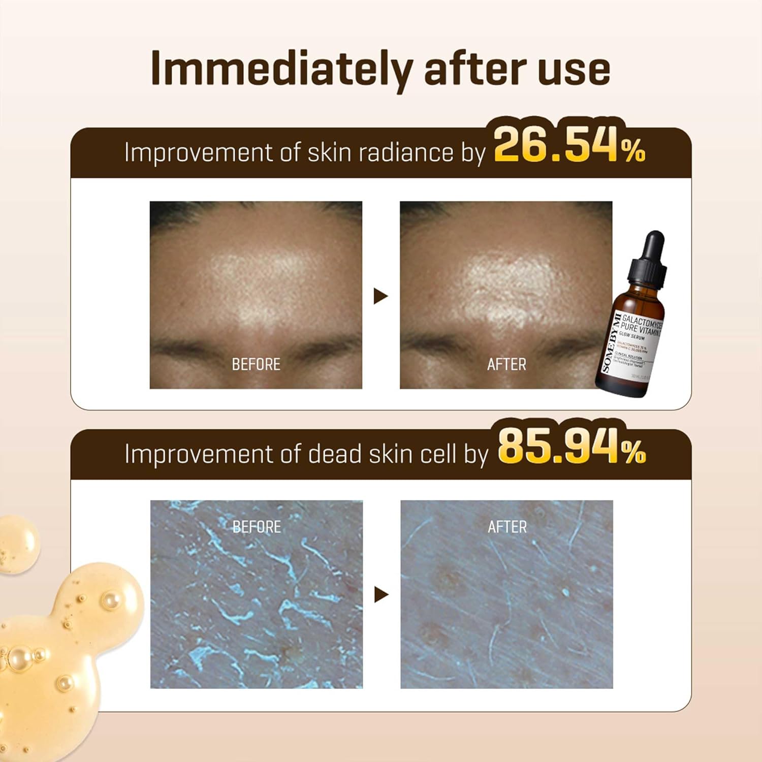 SOME BY MI Galactomyces Pure Vitamin C Glow Serum — how to use: apply a few drops after toner