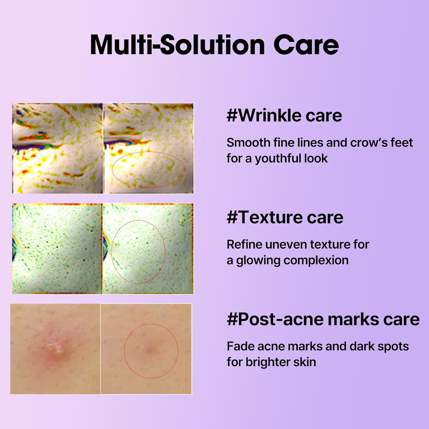 SOME BY MI Retinol Intense Reactivating Serum — gentle retinol care for daily use