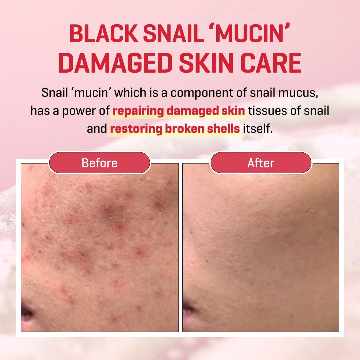SOME BY MI Snail Truecica Miracle Repair Cream — helps strengthen the skin's moisture barrier