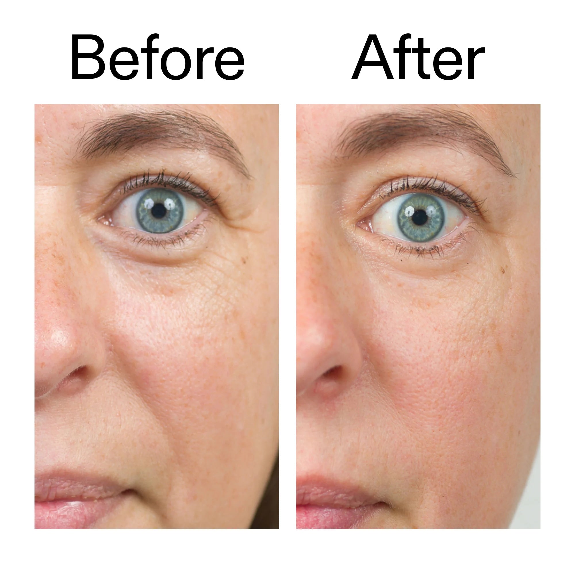 Suitable for dry and sensitive skin