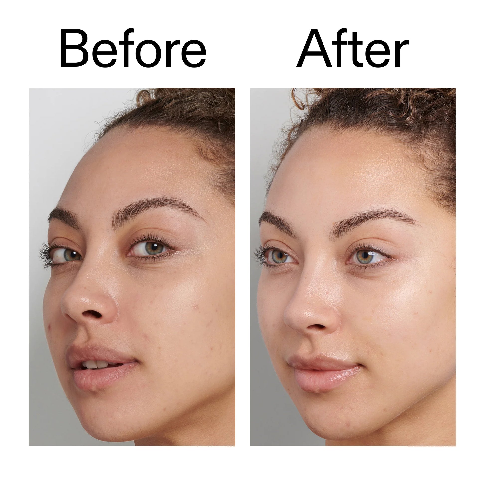Brighter, cleaner-looking skin