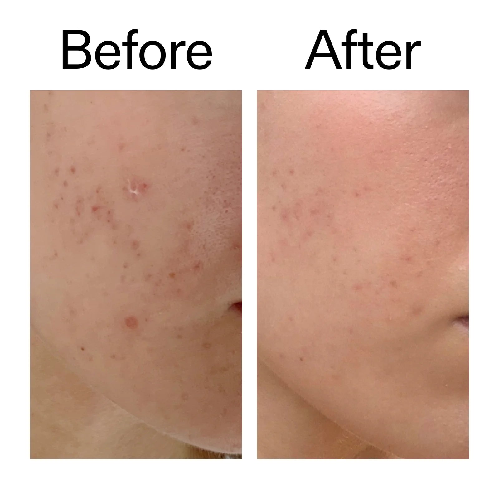 Helps even out skin tone over time