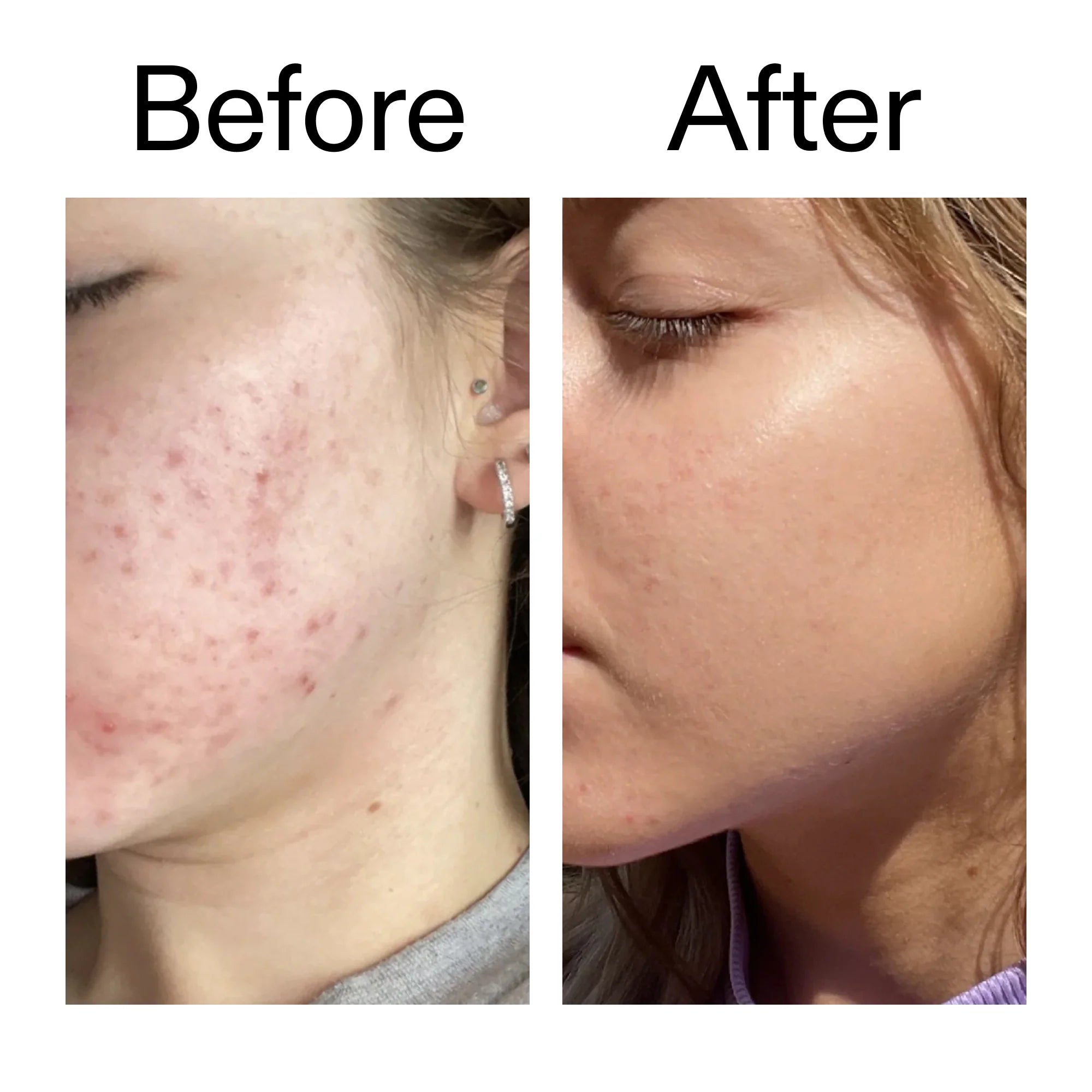 Apply morning and night after cleansing