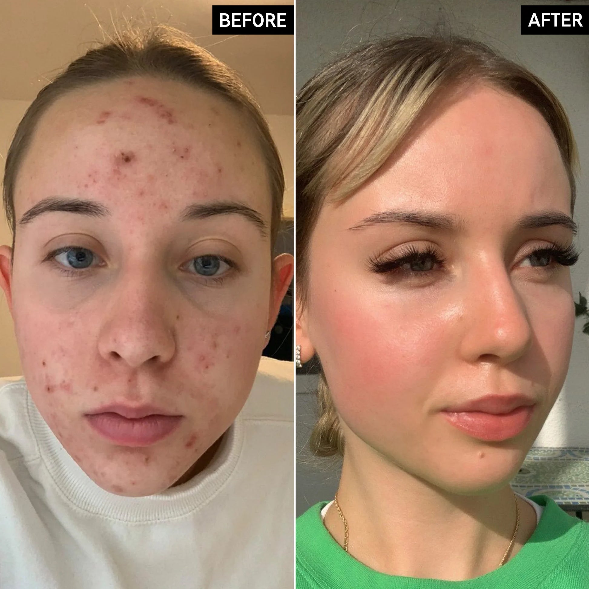 Apply after cleansing, before moisturizer