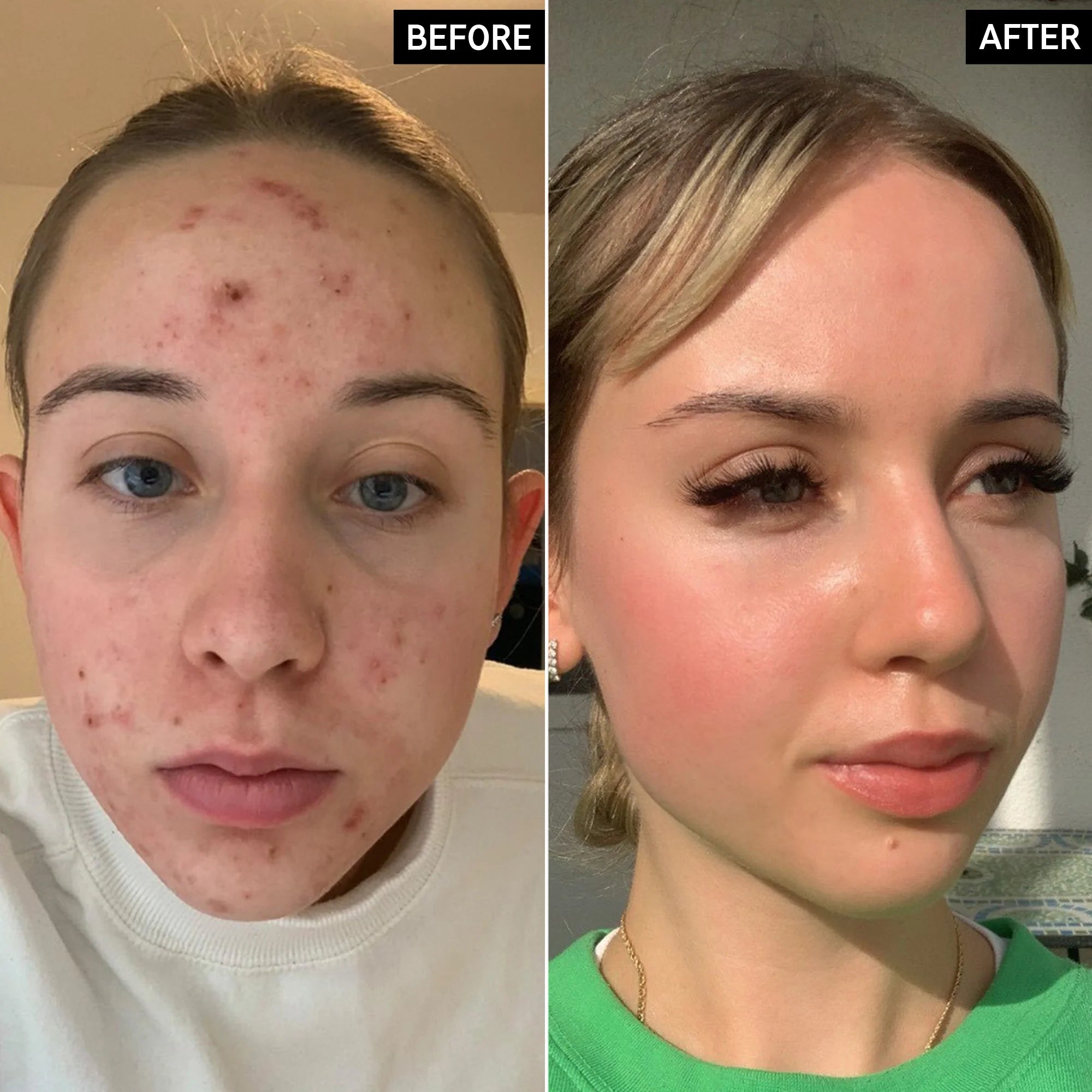 Apply after cleansing, before moisturizer