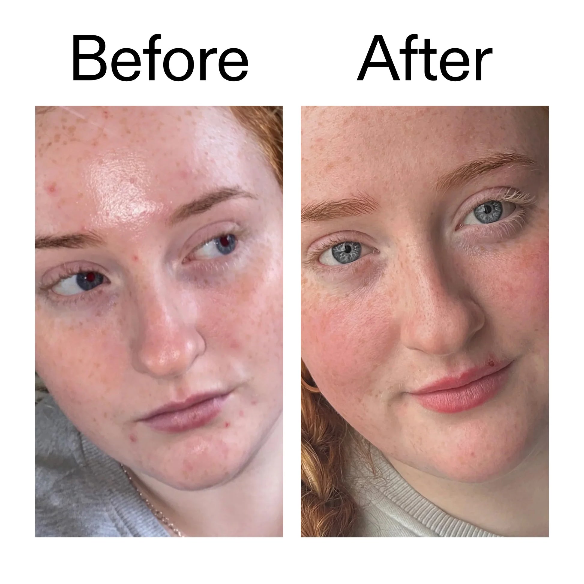 Apply morning and night as the last step