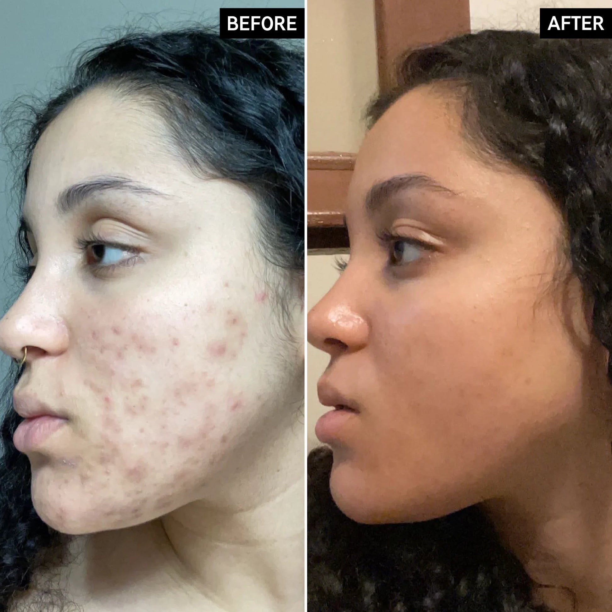 30% vitamin C complex for a radiant glow