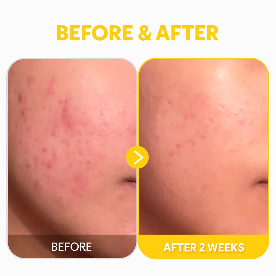 TIRTIR Pure Vitamin C 24% Serum — for dull, tired skin