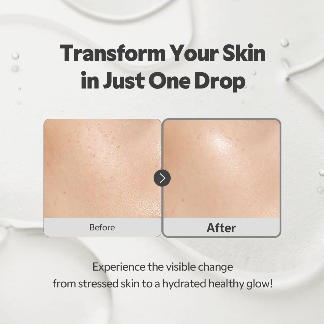 TIRTIR SOS Serum — for sensitive, stressed skin