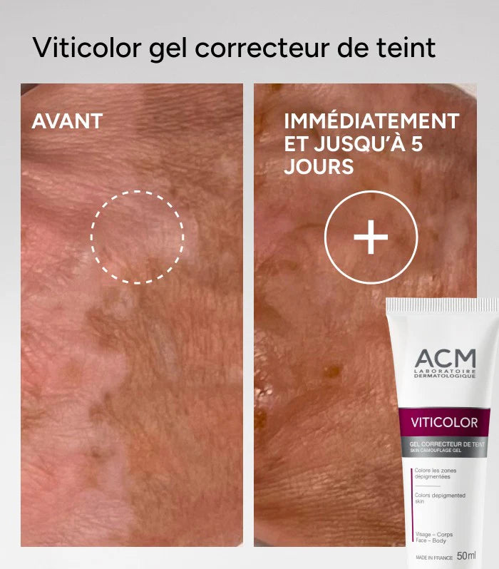 ACM Viticolor Gel Correcteur De Teint