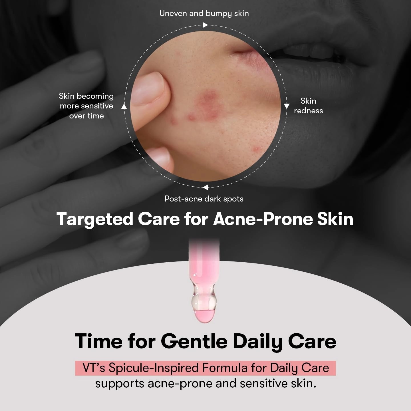 VT Cosmetics Azelaic Acid Calming Ampoule — azelaic complex