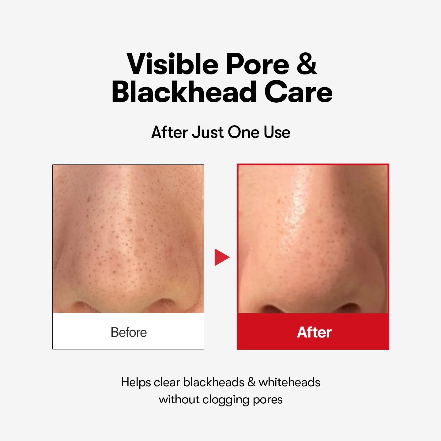VT Cosmetics Azelaic Acid Cleansing Oil — emulsifies on skin