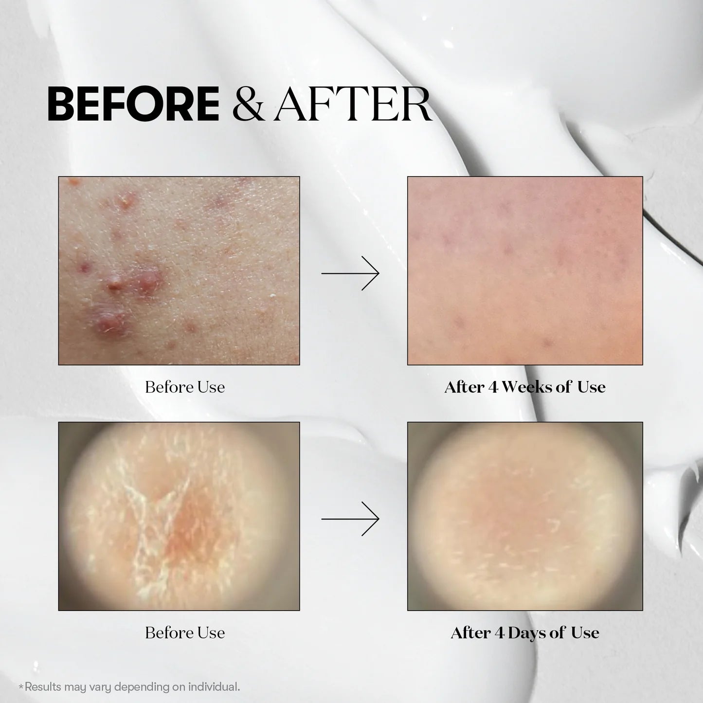 VT Cosmetics Mild Reedle Shot 50 All Day Starter — application