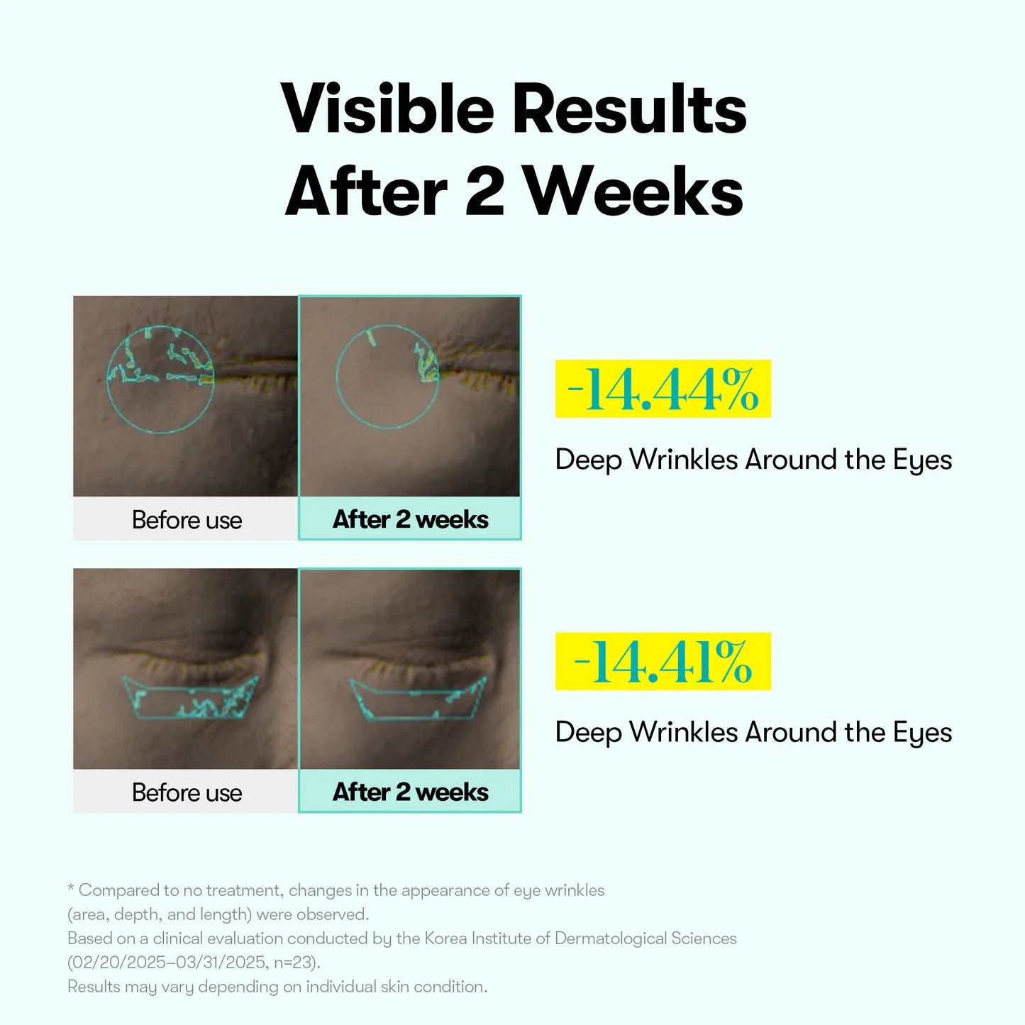 VT Cosmetics PDRN Reedle Shot Eye Lifter — PDRN complex