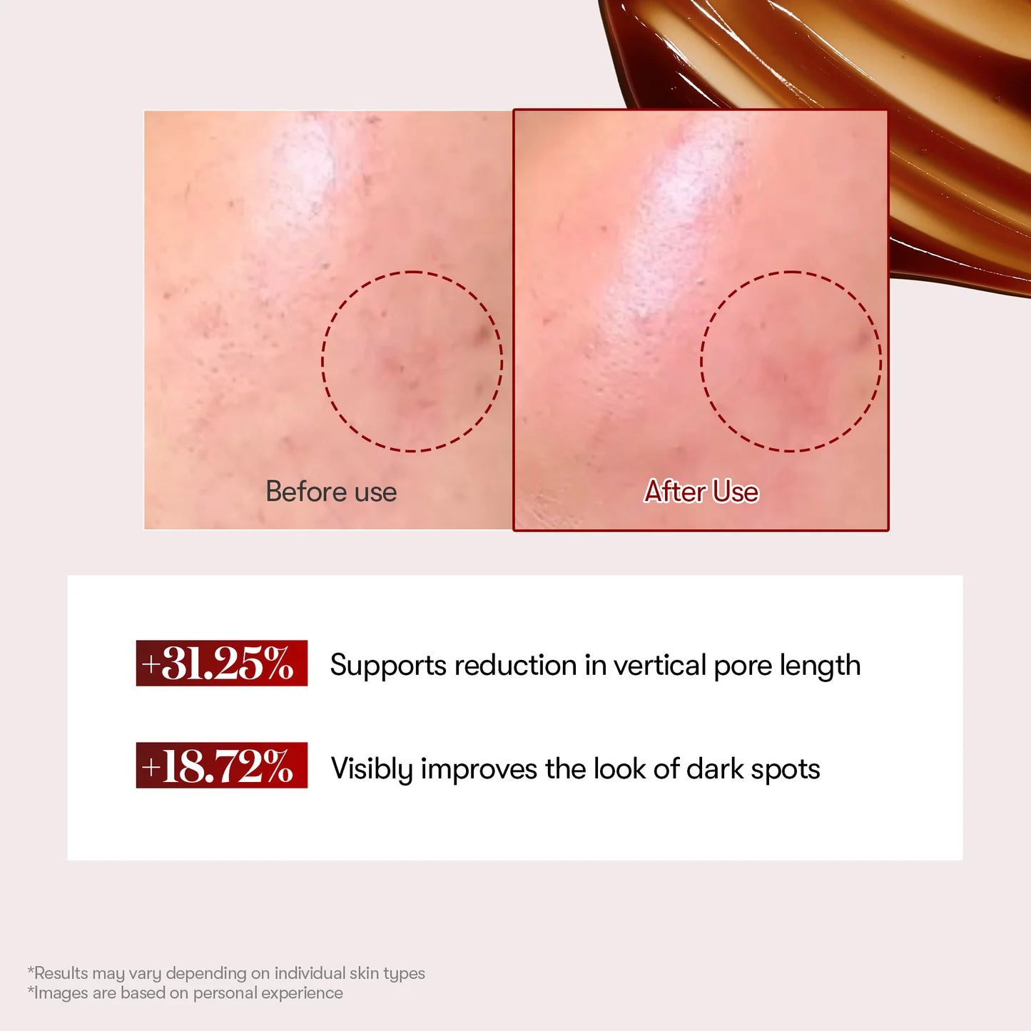 VT Cosmetics Red Booster Reedle Shot 100 — how to use