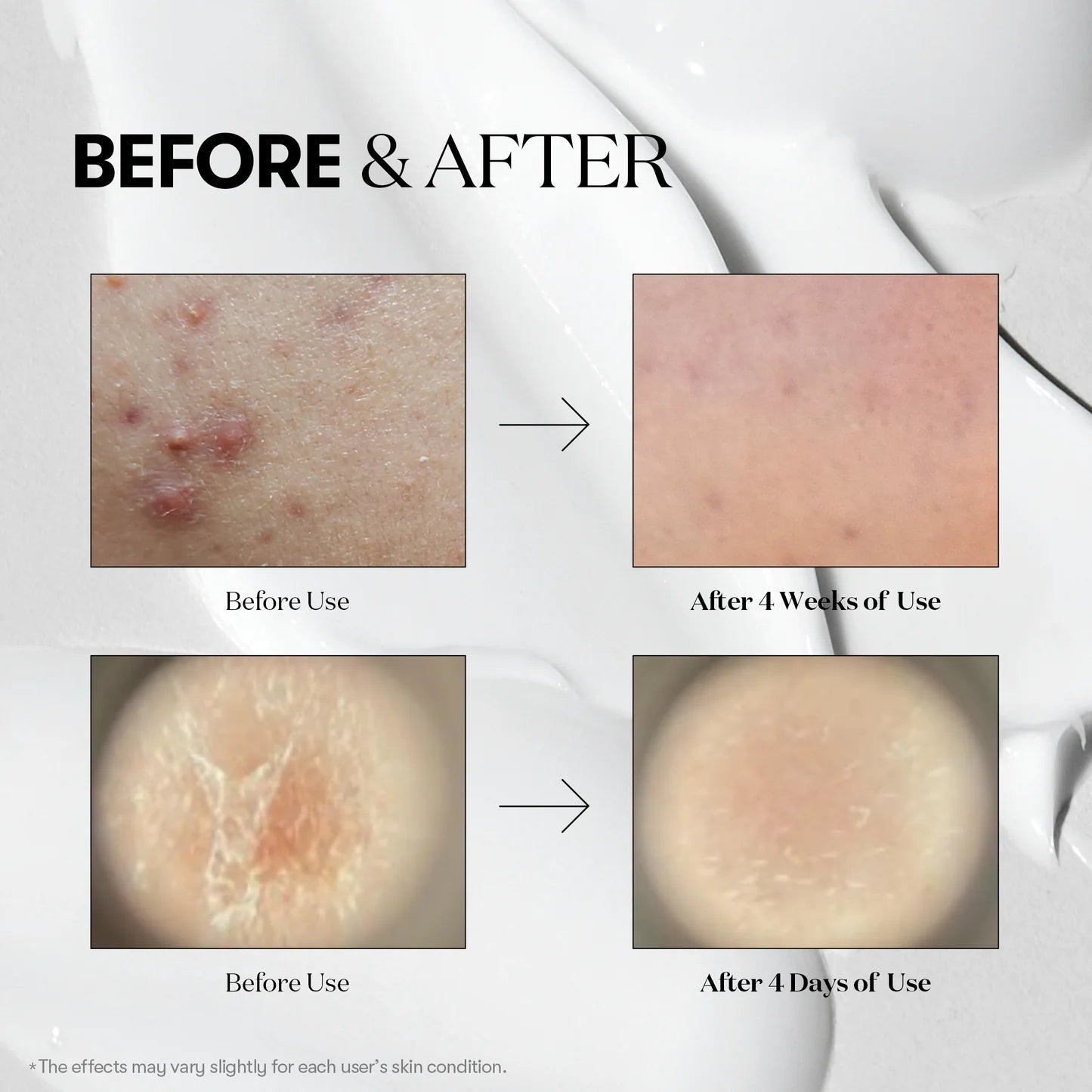 VT Cosmetics Reedle Shot 700 — firm smooth skin