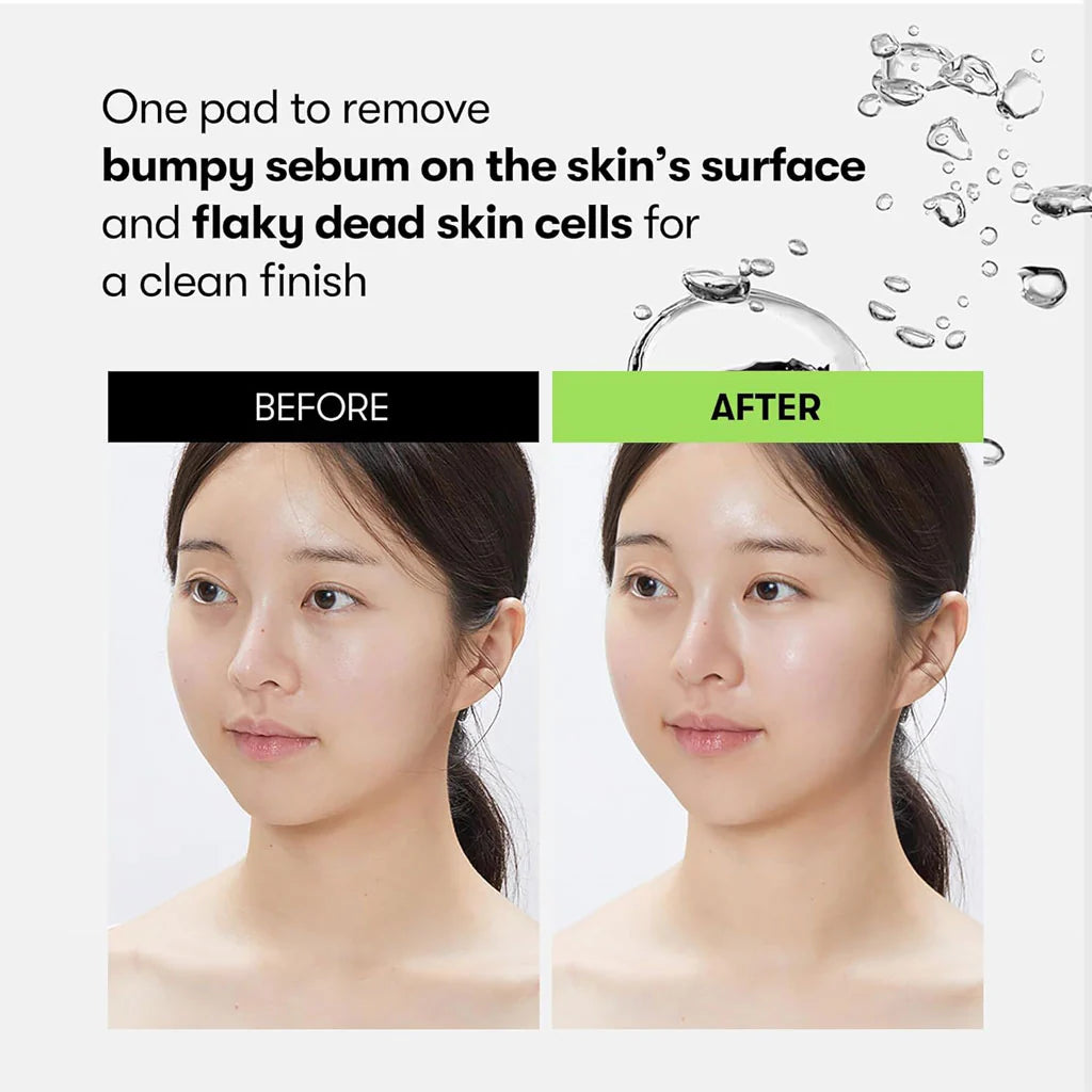 VT Cosmetics Reedle Shot Synergy Sparkling Toner Pad — clear smooth skin