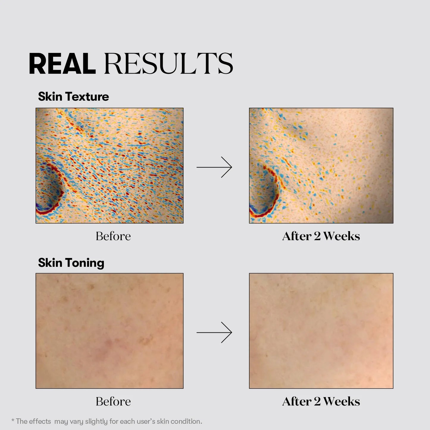 VT Cosmetics TX Toning Essence 1000 Shot — application